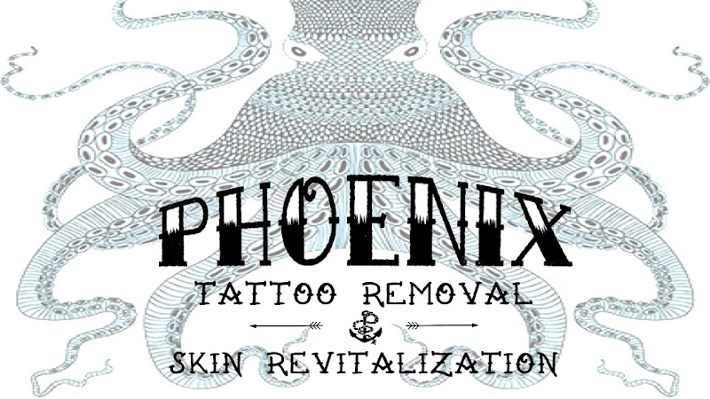 Tattoo Removal (0) in Scottsdale AZ