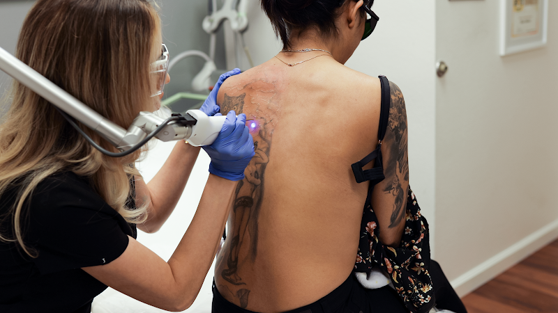 Reviews  Laser Tattoo Fading  Removal Adelaide  LaserTat