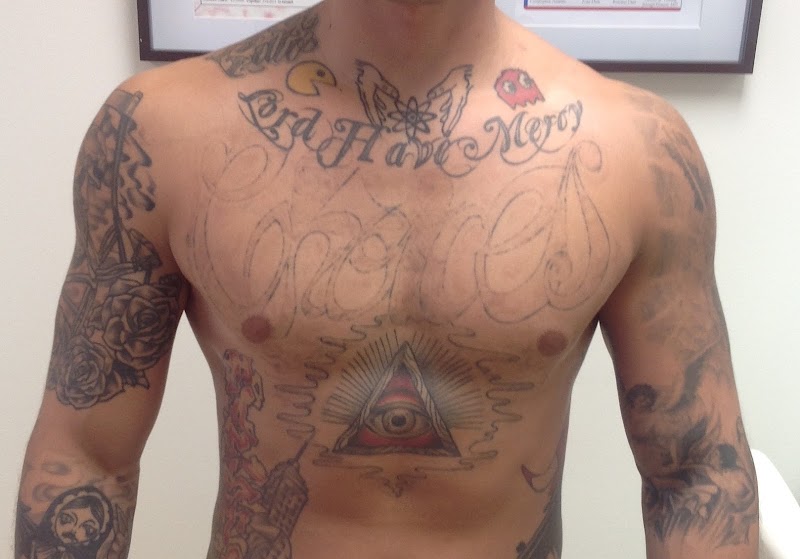 Uncover 10 Fantastic Tattoo Removal Options in Honolulu HI