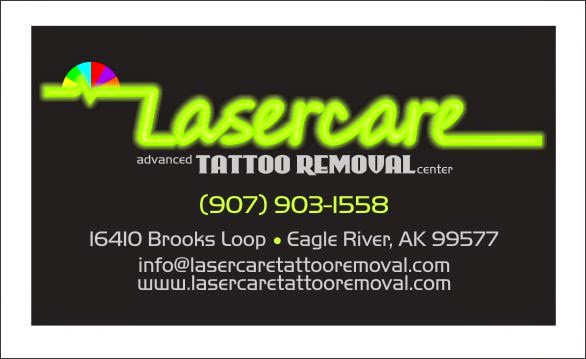 Tattoo Removal (3) in Anchorage AK