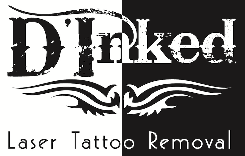 Tattoo Removal (3) in Chesapeake VA