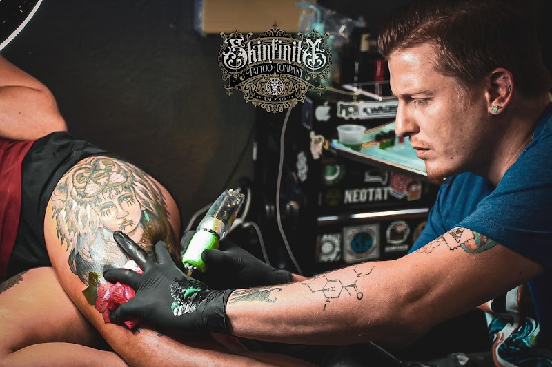 Tattoo Removal (3) in Winter Haven FL